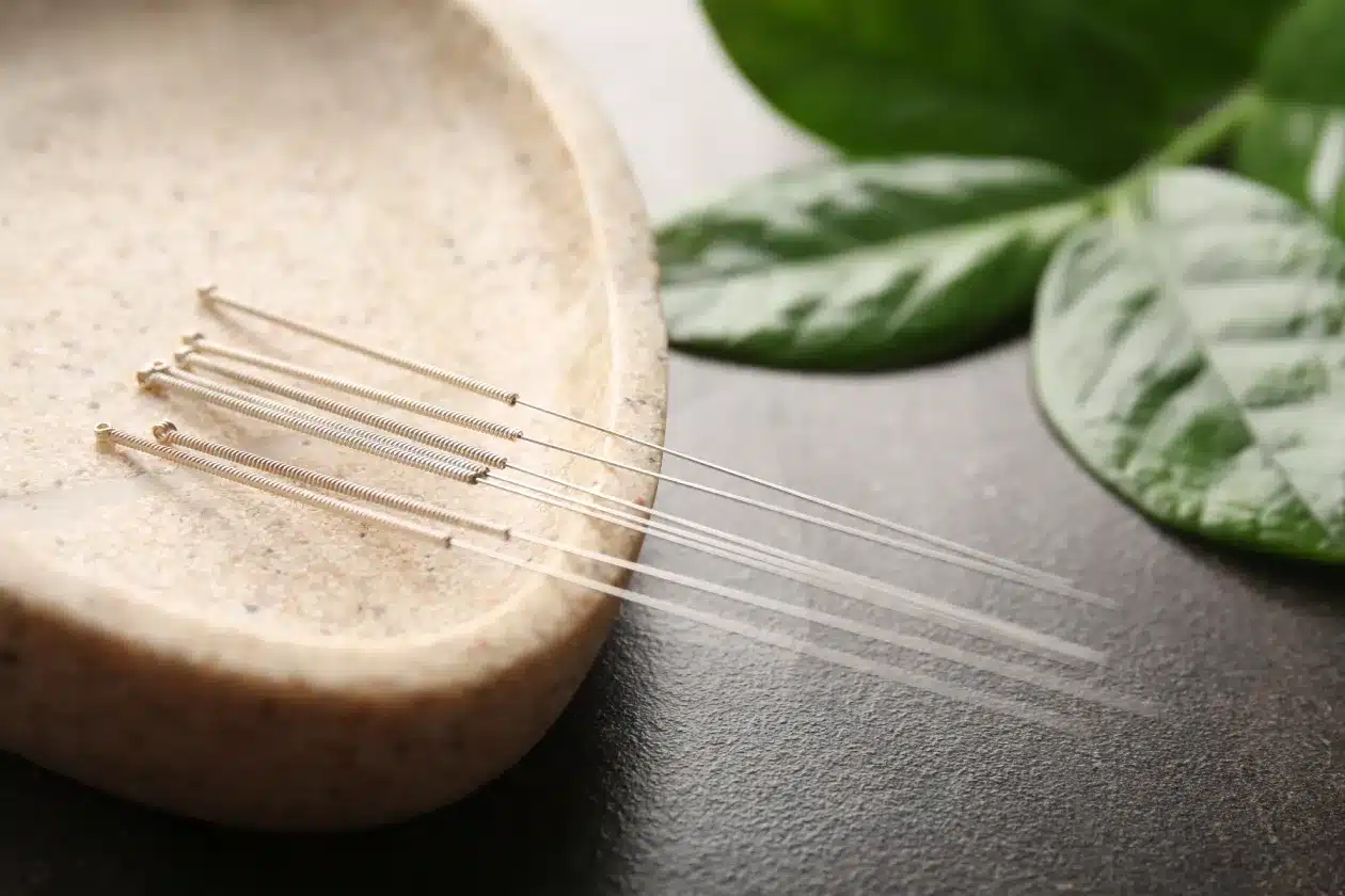 Custom Acupuncture at HealthSpine Chiropractic