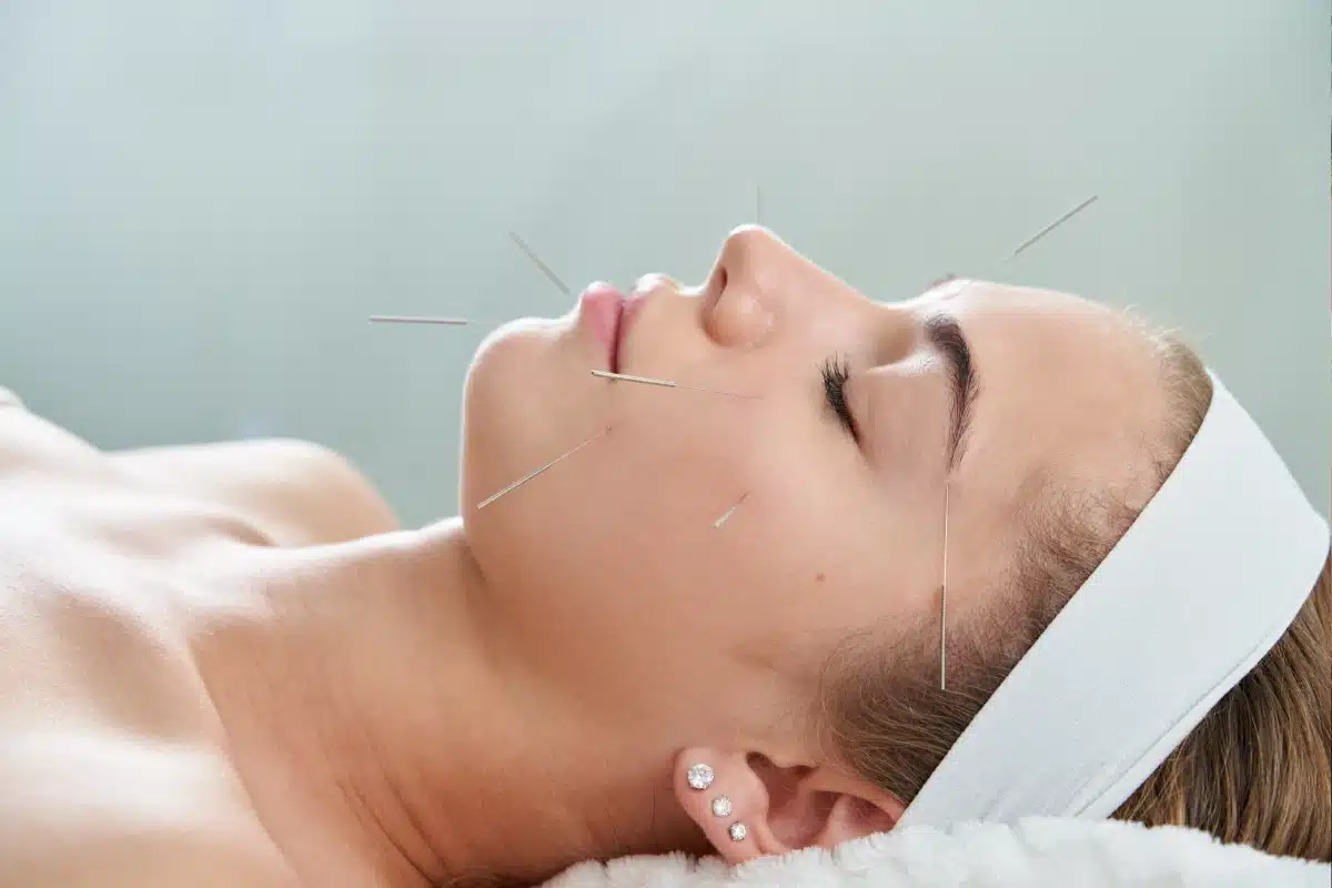 GlowLift Cosmetic Acupuncture Image