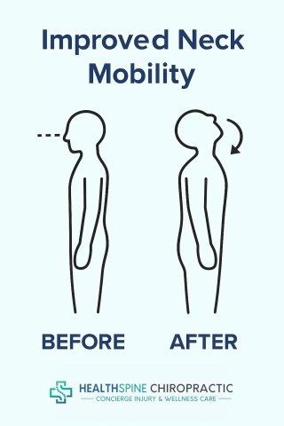 Improved Neck Mobility Whiplash Treatment